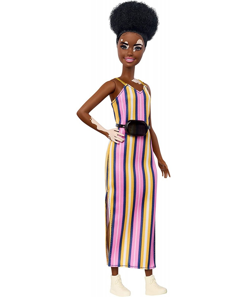 Fashionistas Doll with Vitiligo and Curly Brunette Hair Wearing Striped Dress and Accessories for 3 to 8 Year Olds $26.67 - D...