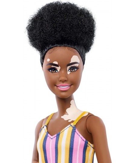 Fashionistas Doll with Vitiligo and Curly Brunette Hair Wearing Striped Dress and Accessories for 3 to 8 Year Olds $26.67 - D...